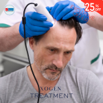 EXCLUSIVE offer- hair loss 25% off